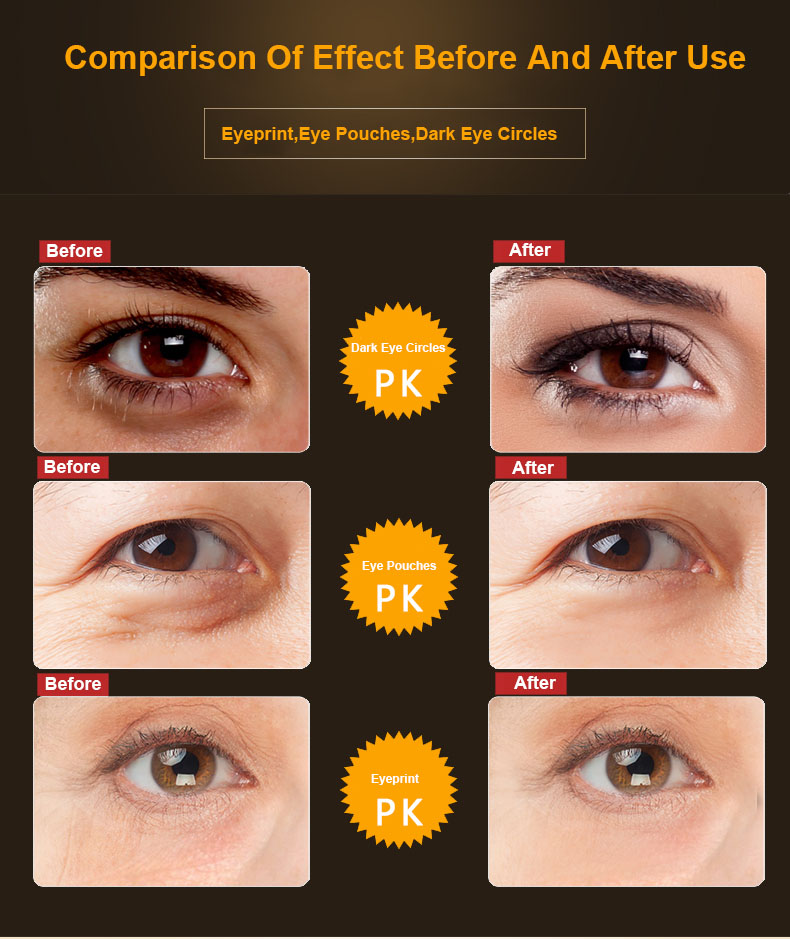 Factory New Desgin Promasks Brand Caviar Anti Aging Facial Eye Cream Care Set