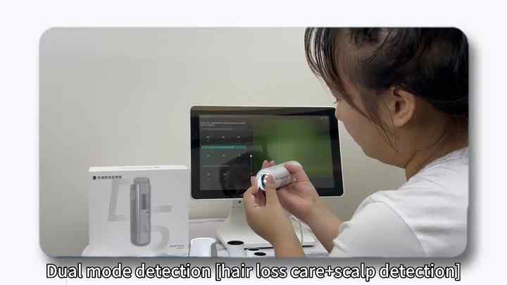 Portable 3D Skin Analyzer Hair Scalp Machine Hair Scalp Scanner for ...