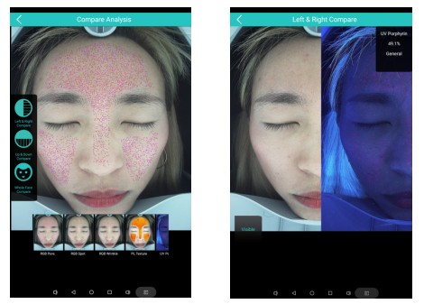 Magic Mirror 3D Skin Analysis Machine Portable With Touch Screen