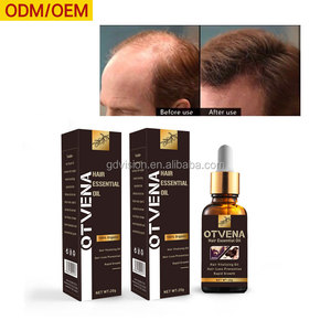 Vital Hair Care Products Vital Hair Care Products Suppliers And