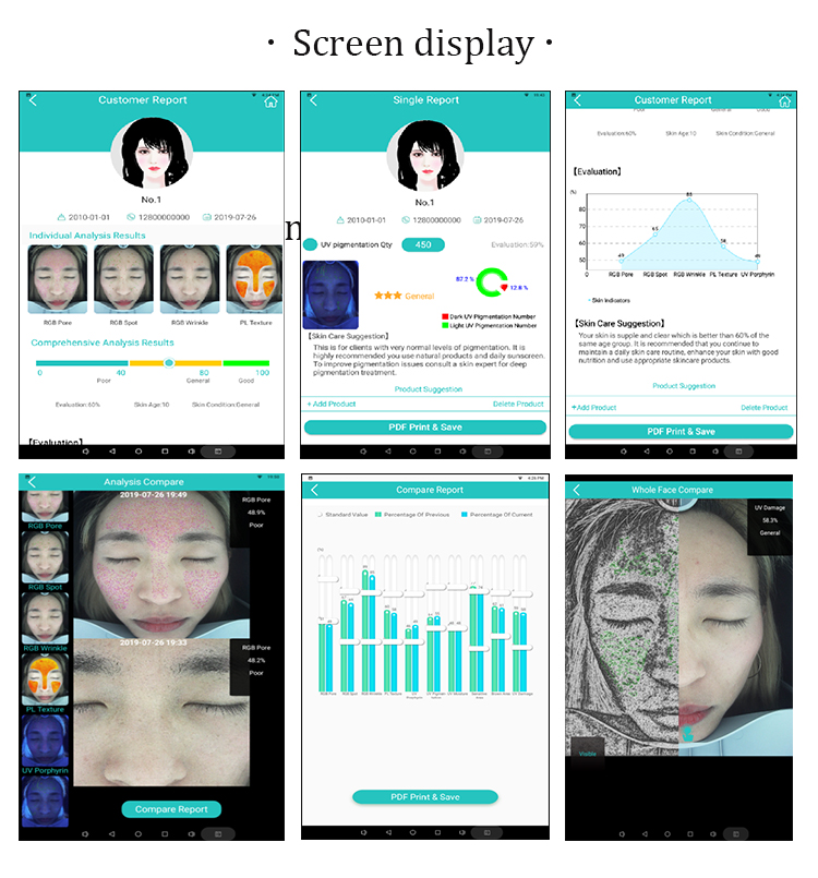 ABS Facial Skin Tone Scanner 45W 20 Megapixel Facial Diagnostic Analyzer