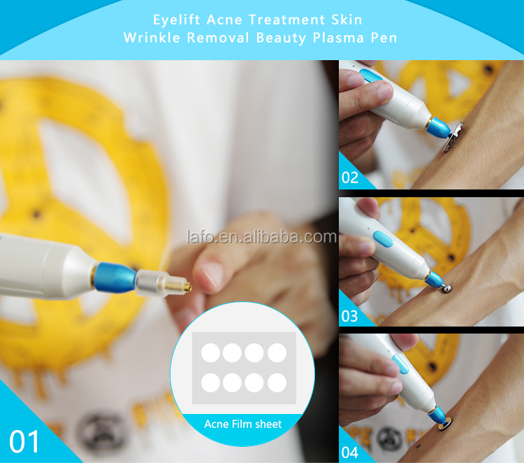 factory direct sale Korea plamere plasma pen eye lift skin rejuvenation