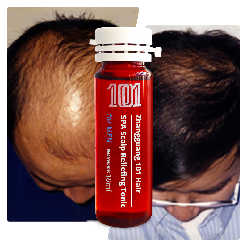 Частная этикетка органический ремонт поврежденных волос роста сыворотки для мужчин