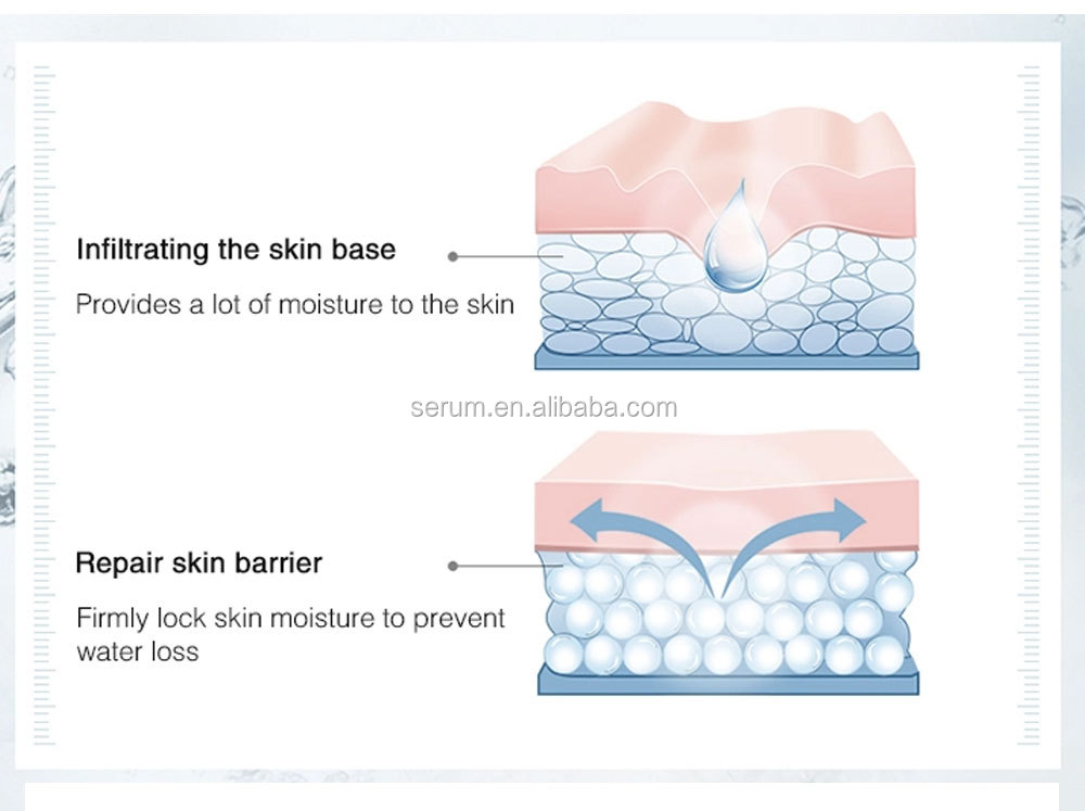 Custom Brand Hyaluronic Acid Serum For Skin Care Kojic Acid Serum Glutathione Plant Extract Whitening Serum