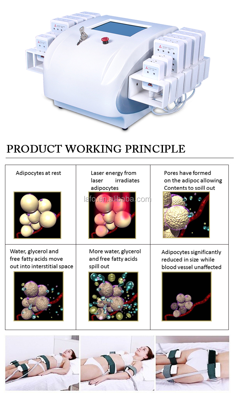 CE Approved Best Dual Wavelength Lipo Cold Laser 650nm 980nm Lipo Laser Lipolaser Machines for Sale LF-318