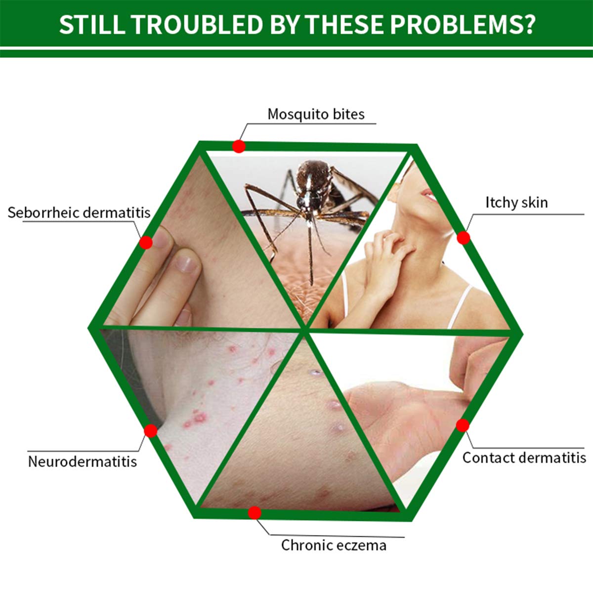 OEM Factory Supply Private Label Herbal Body Skin Care Cream Repair Treatment Cream