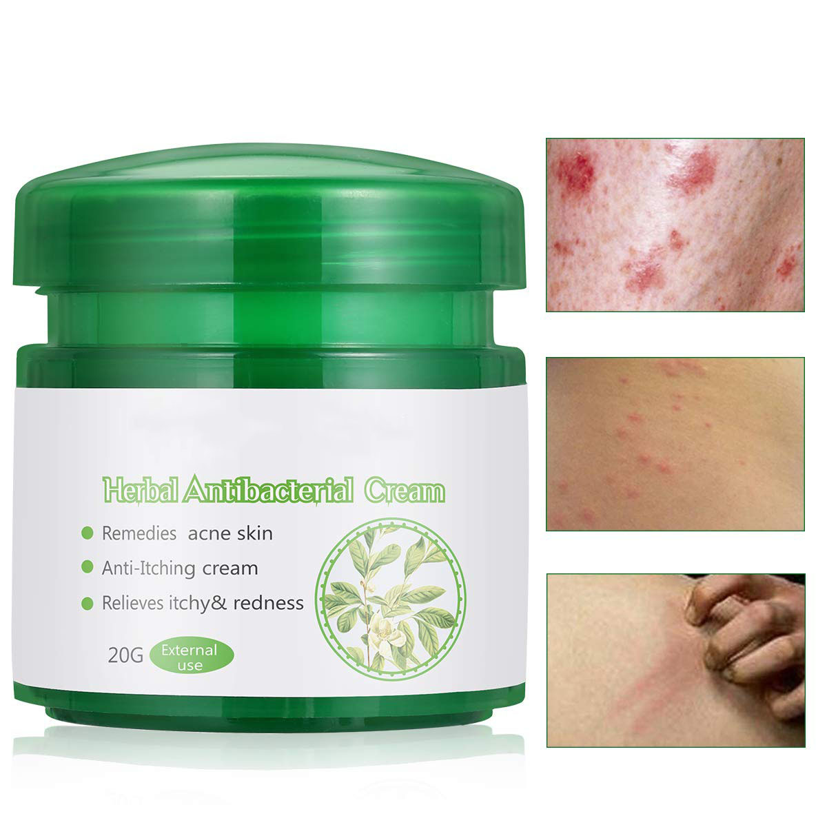 OEM Factory Supply Private Label Herbal Body Skin Care Cream Repair Treatment Cream