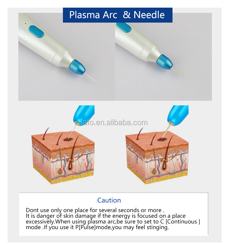 factory direct sale Korea plamere plasma pen eye lift skin rejuvenation