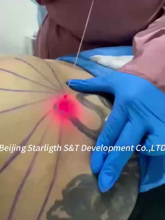 Lipo Elyon Dual Laser Subdermico Endolaser Diodo 980 Fibra Machine