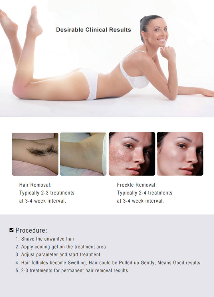 Kes Newest 3500W ipl laser hair removal machine / ipl opt shr Elight rf nd yag laser with 200000shots