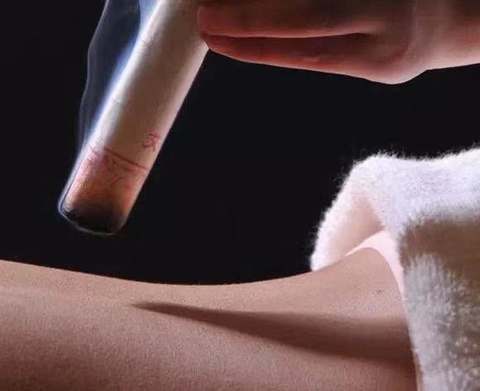 moxa, moxa direct from shenzhen imdk medical technology co., ltd