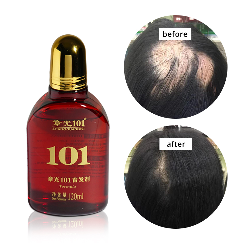 Травяной экстракт Органическая алопеция лечение роста волос сыворотка для роста волос