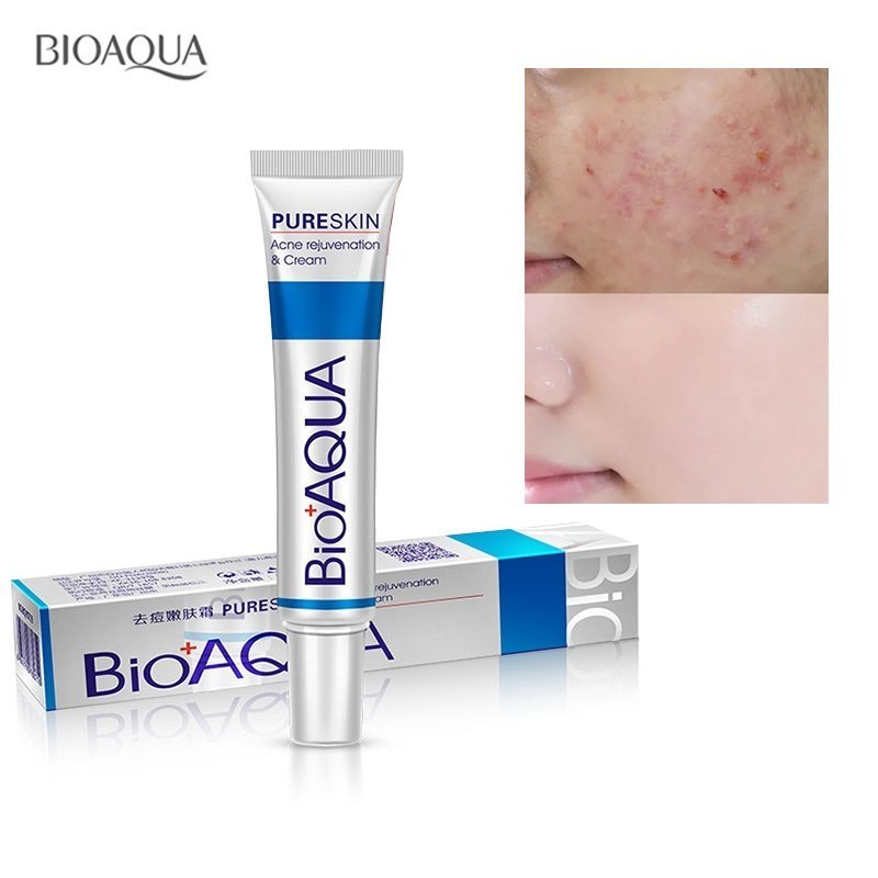 BIOAOUA 30g Acne Treatment Blackhead Remova Anti Acne Cream Oil Control Shrink Pores Acne Scar Remove Face Care Whitening