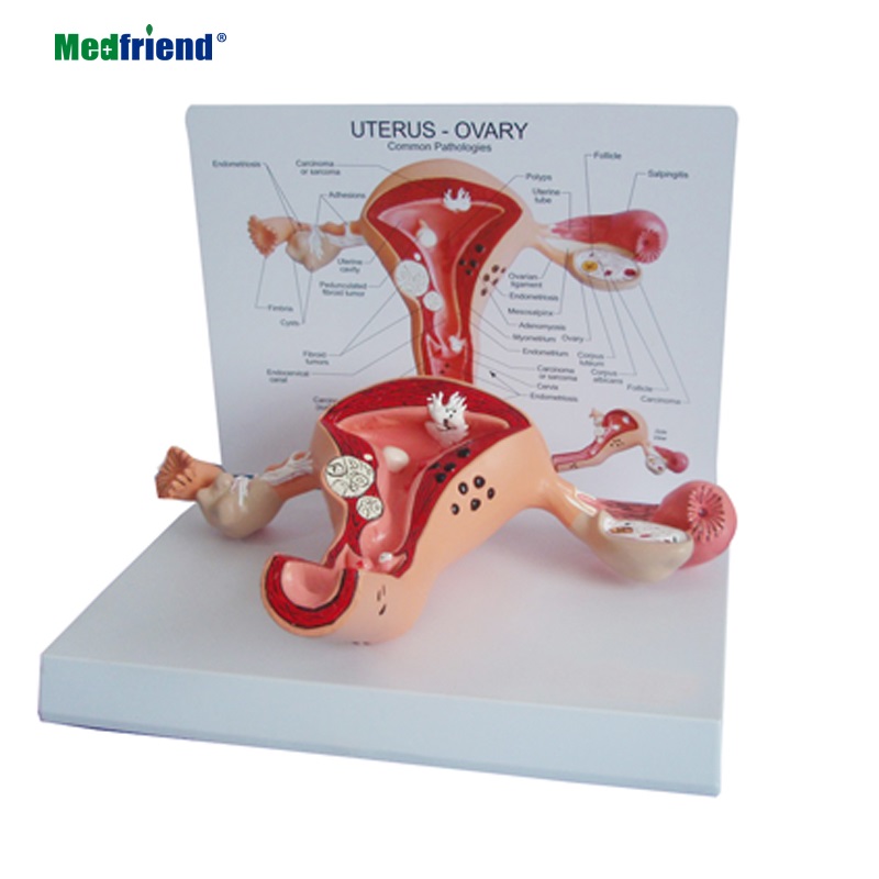 Цена по прейскуранту завода анатомическая Женская матка яичник модель с патологиями