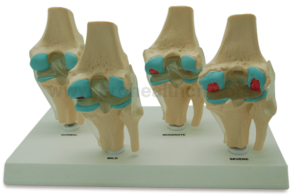 3件正常/平/弓脚,解剖脚模型
