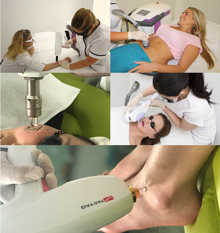 Er yag er glass 1064 long pulse qs laser ipl epl rf laser beauty equipment