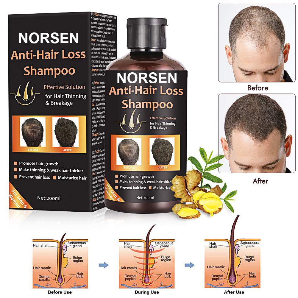 Hot Selling Products Organic Anti-Hair Loss Shampoo For Promote Hair Growth