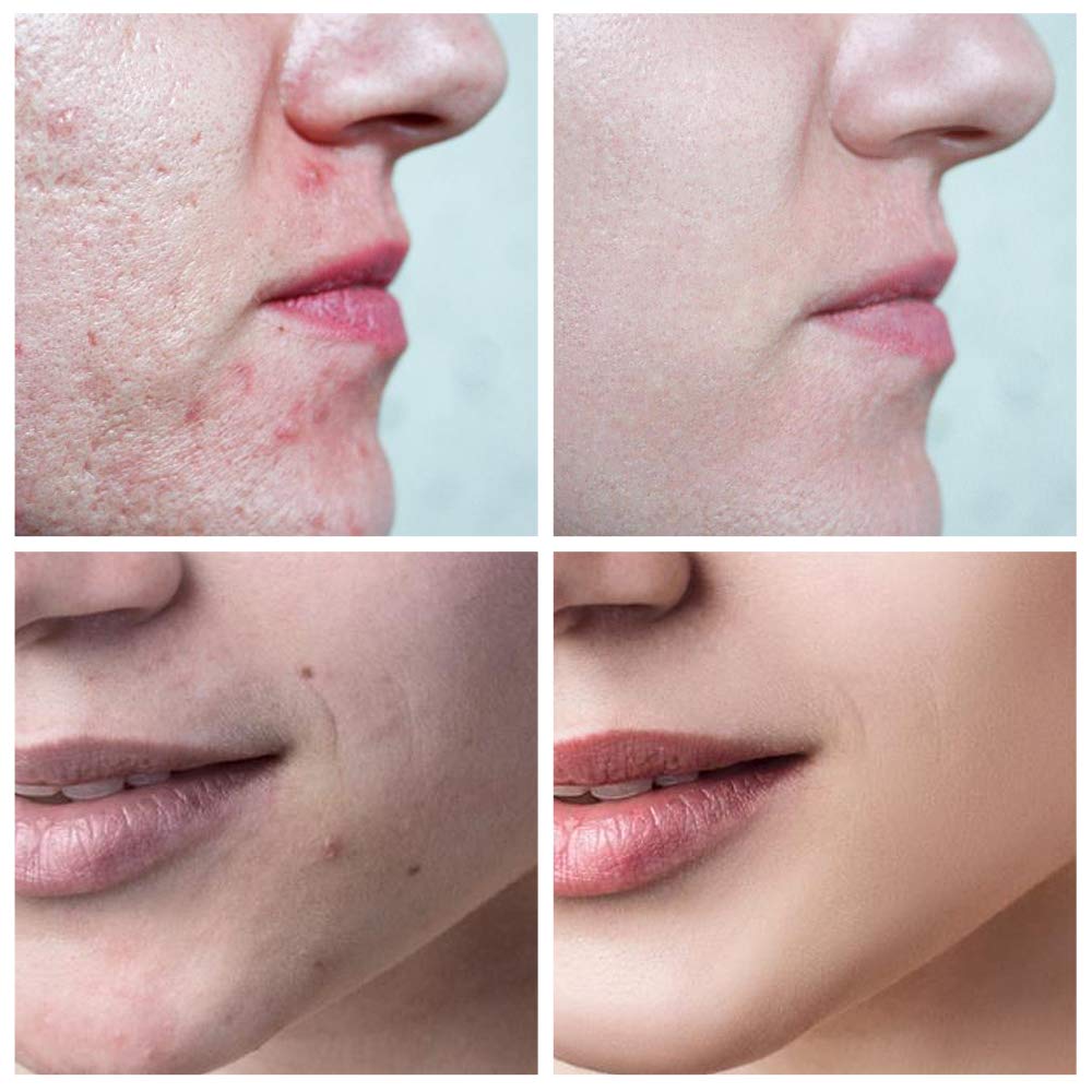 Private Label Organic Skin Care Anti Aging Vitamin C Sheet Face Mask