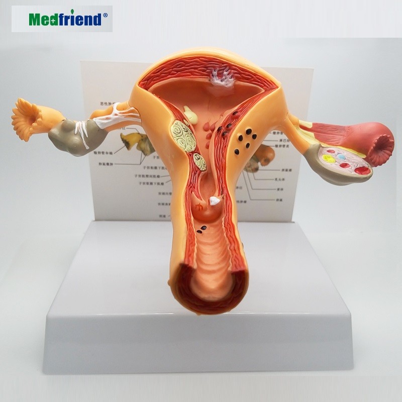 生命大小医疗妇女内部生殖解剖学模型子宫模型生殖结构妇科解剖 mod