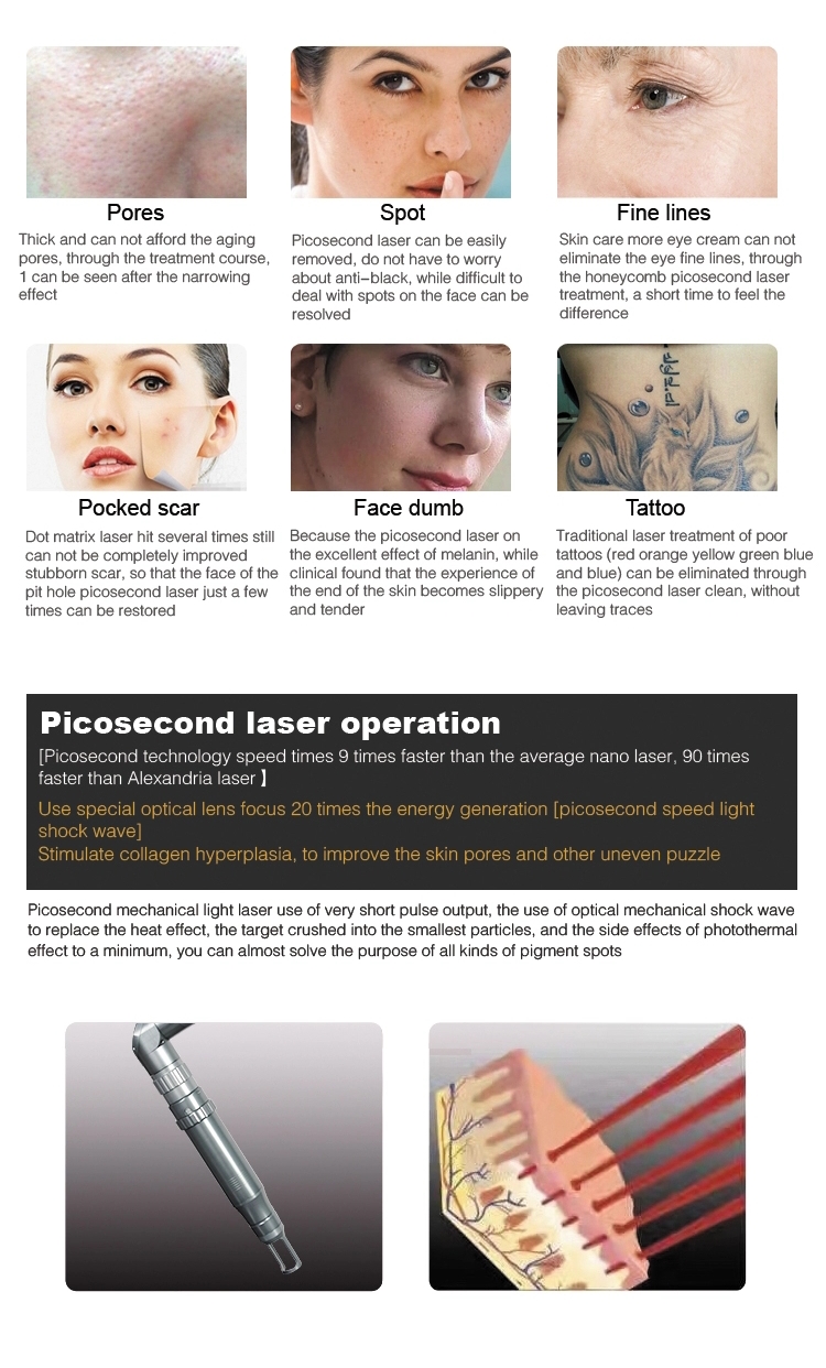 Advanced Nd Yag Laser Tattoo Removal Machine 532nm 1064nm Q Switch Nd Yag Laser Machine
