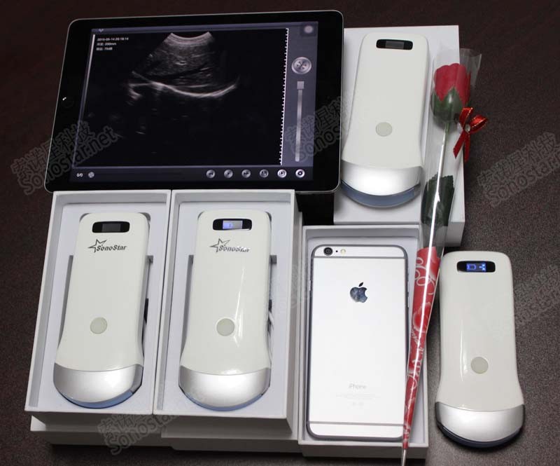 UProbe-2 handheld wireless Ultrasound scanner (working on iPad & iPhone)