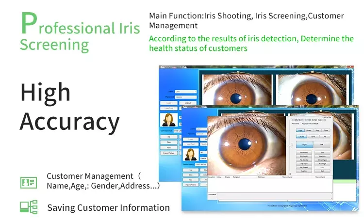 Portable Iriscope Iris Analyzer Auto Iridology Camera Eye Iriscope Analyzer Software