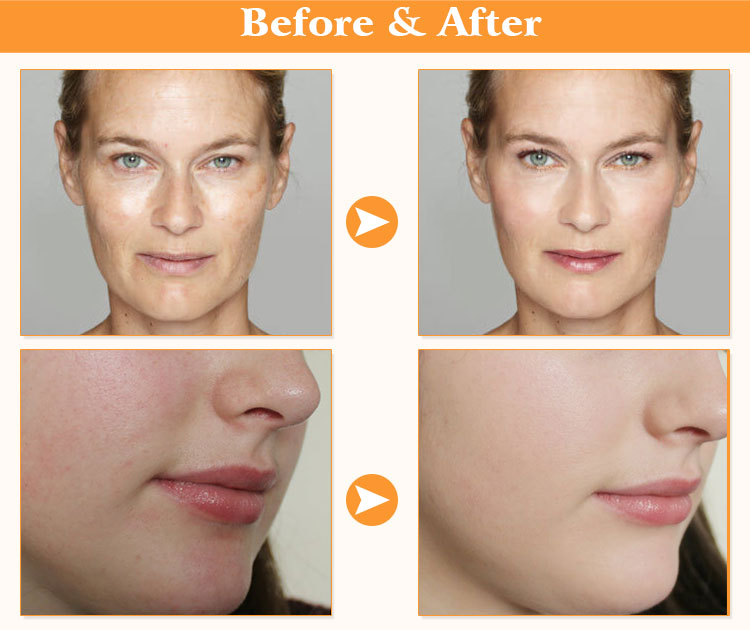 Oem Skin Care Advanced Formula 20% Vitamin C Pure 100 Serums
