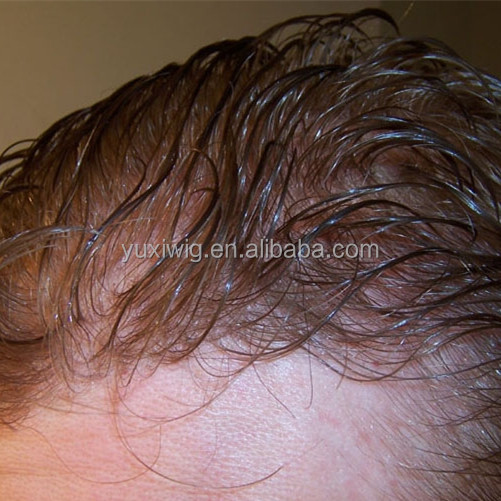 Hair Replacement System For Men Lace Hair System For Men Thin Skin