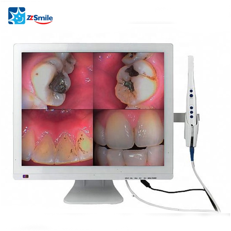 Dental intraorale Kamera LCD Monitor LCD Halterung m-22