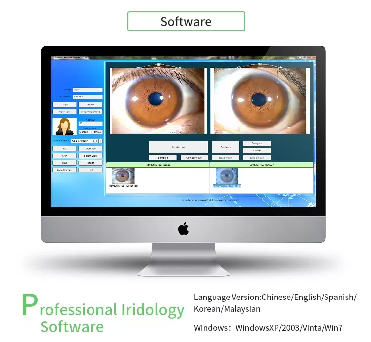 Portable Iriscope Iris Analyzer Auto Iridology Camera Eye Iriscope Analyzer Software