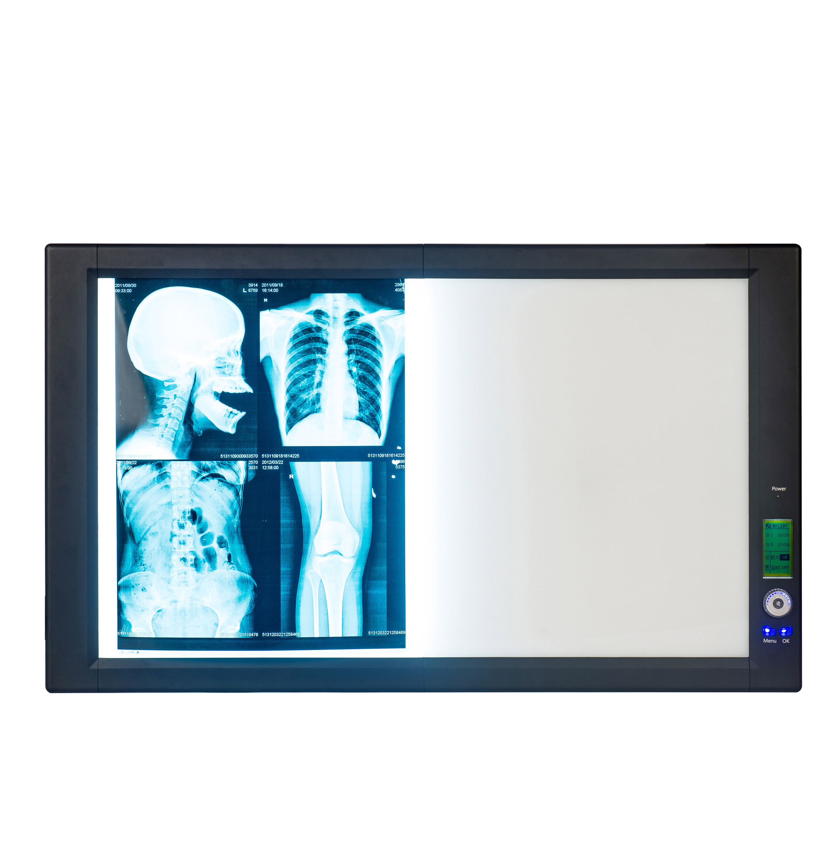 Светодио дный Регулируемая яркость высокая яркость X-ray портативные киноскоп цена