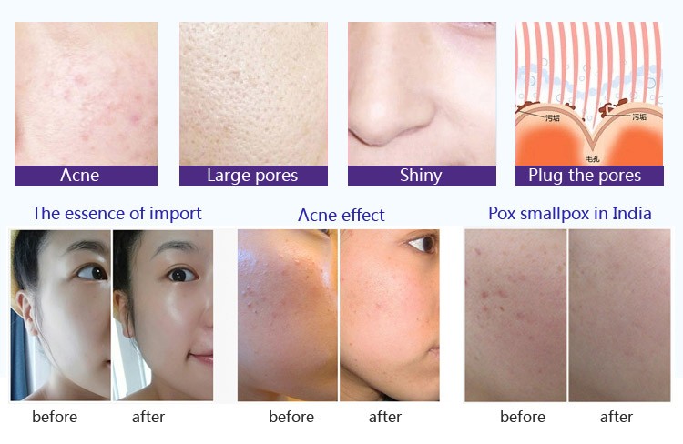 12 Needles Micro Needling derma pen machine electric mesotherap derma pen Wireless Microneedle derma pen m8