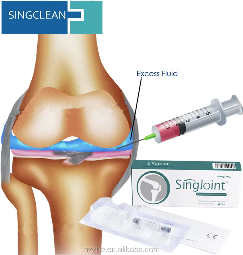 Можно в коленный сустав делать уколы. Введение гиалуроновой кислоты в сустав. Уколы в коленный сустав с гиалуроновой кислотой. Гиалуроновая кислота для суставов уколы. Натрия гиалуронат уколы в сустав.