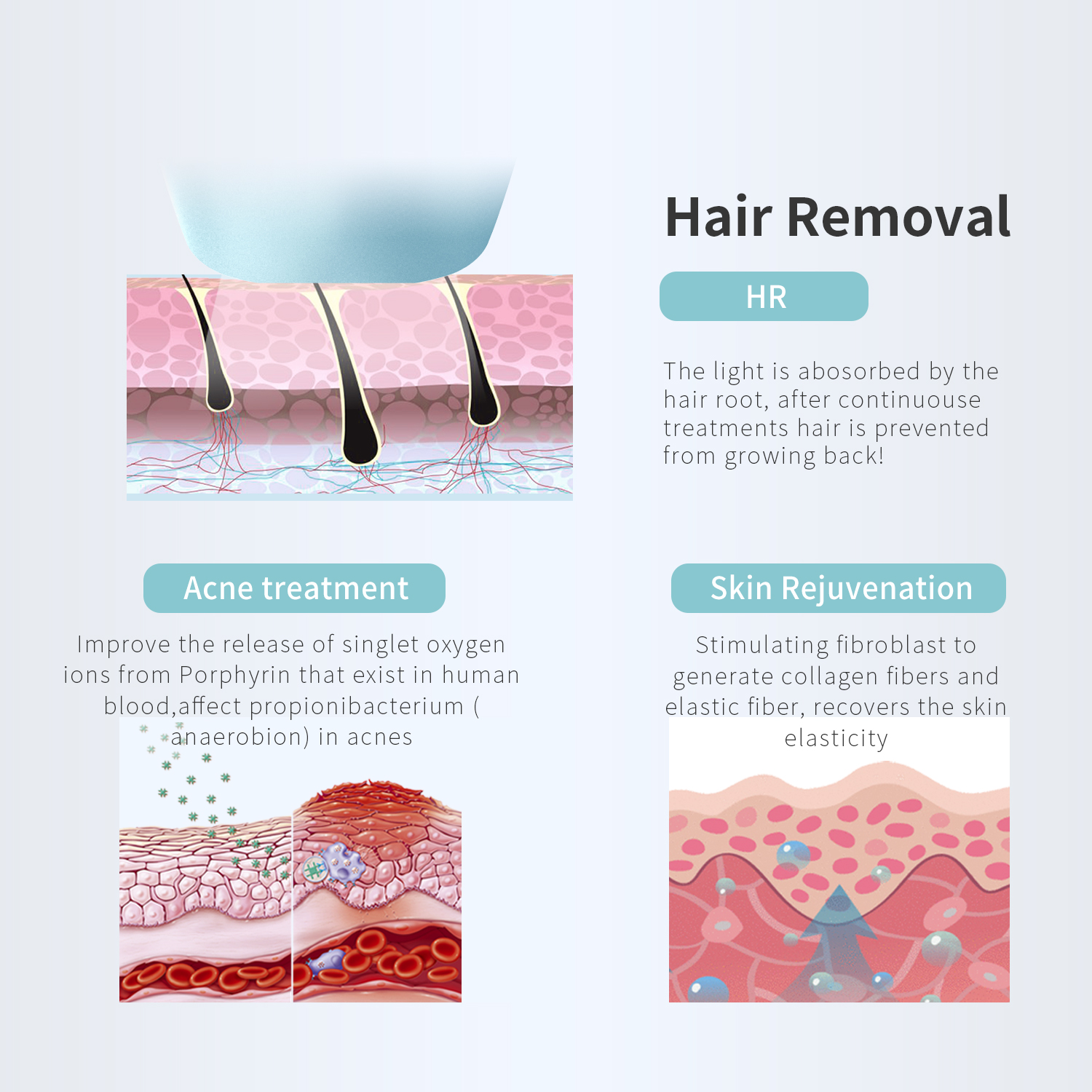 Portablepainless ipl hair removal home use intense pulsed light ipl hair removal for home use