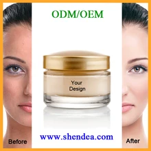 best night cream for pigmentation
