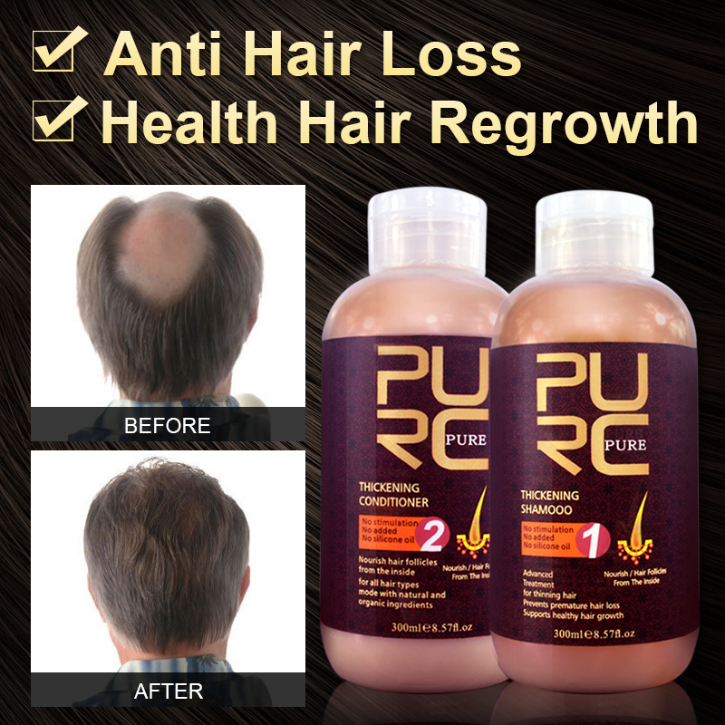 China Garlic Hair Loss China Garlic Hair Loss Manufacturers And