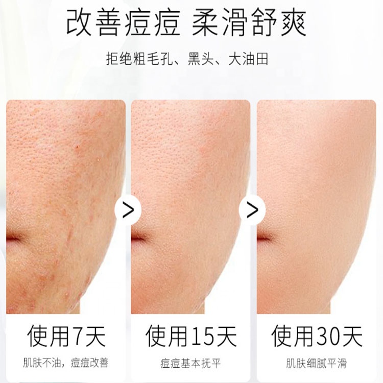 100% природа мыло Private label ручной Глубокая чистка, масло contarl Лучшие Органические удаления сыр мыло