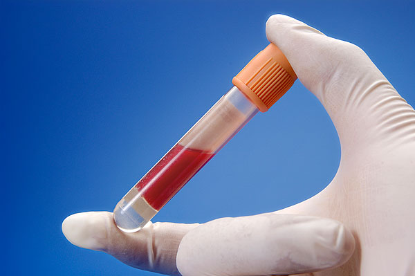 一次性医疗用品2毫升真空pt采血管: - buy pt blood collection tube