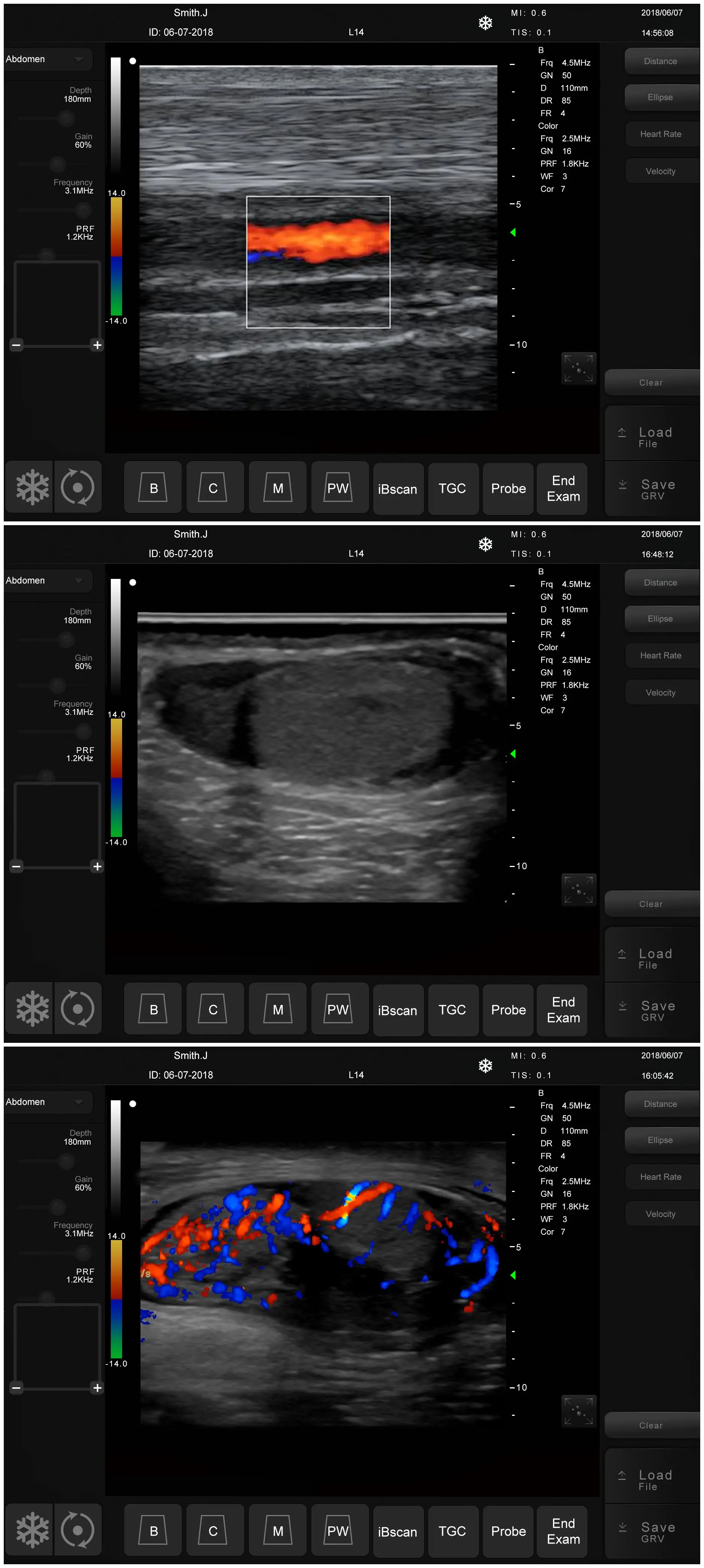 MSLVU45 portable veterinary ultrasound/color doppler ultrasound machine price