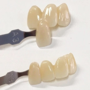 High Quality Ceramics 3D Zirconia Block Dental Material High Quality Ceramics 3D Zirconia Block Dental Material