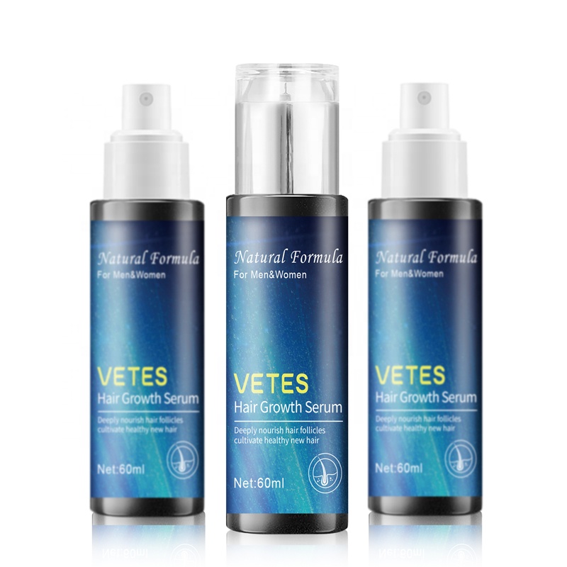 OEM Сыворотка против выпадения волос, масло для роста волос, органическое эфирное масло для роста волос