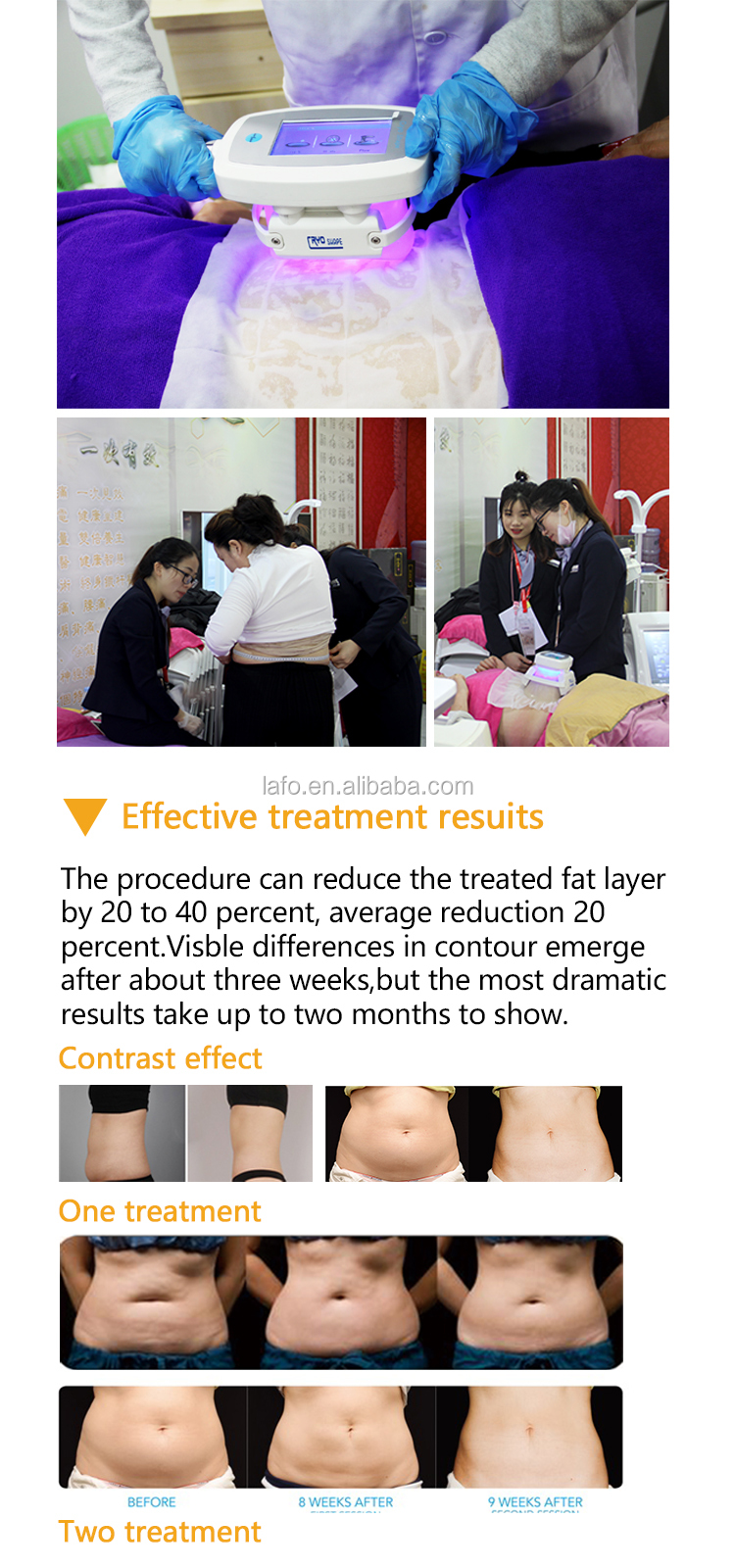 Professional stationary 360 Cool system Cryolipolysis Weight Loss Cryo Double Chin Removal Machine LF-245B