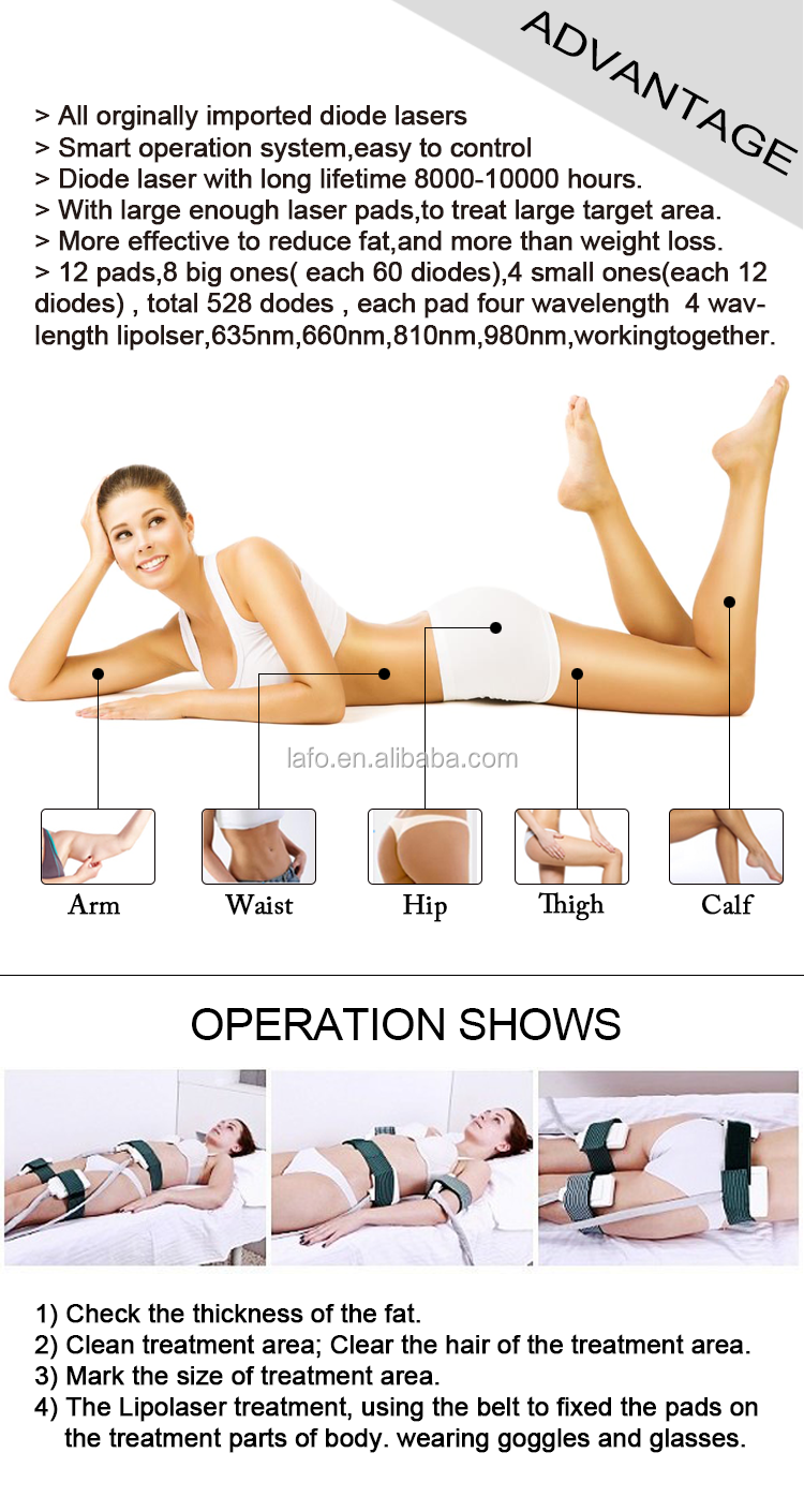 Best Hot Selling 528 Diodes Cold Lipolaser Professional Lipo Laser Machine Lipolaser 4d For Super Lose Weight