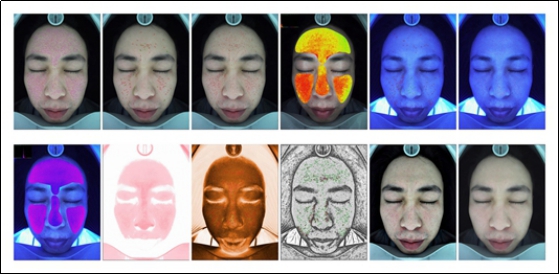 Magic Mirror 3D Skin Analysis Machine Portable With Touch Screen