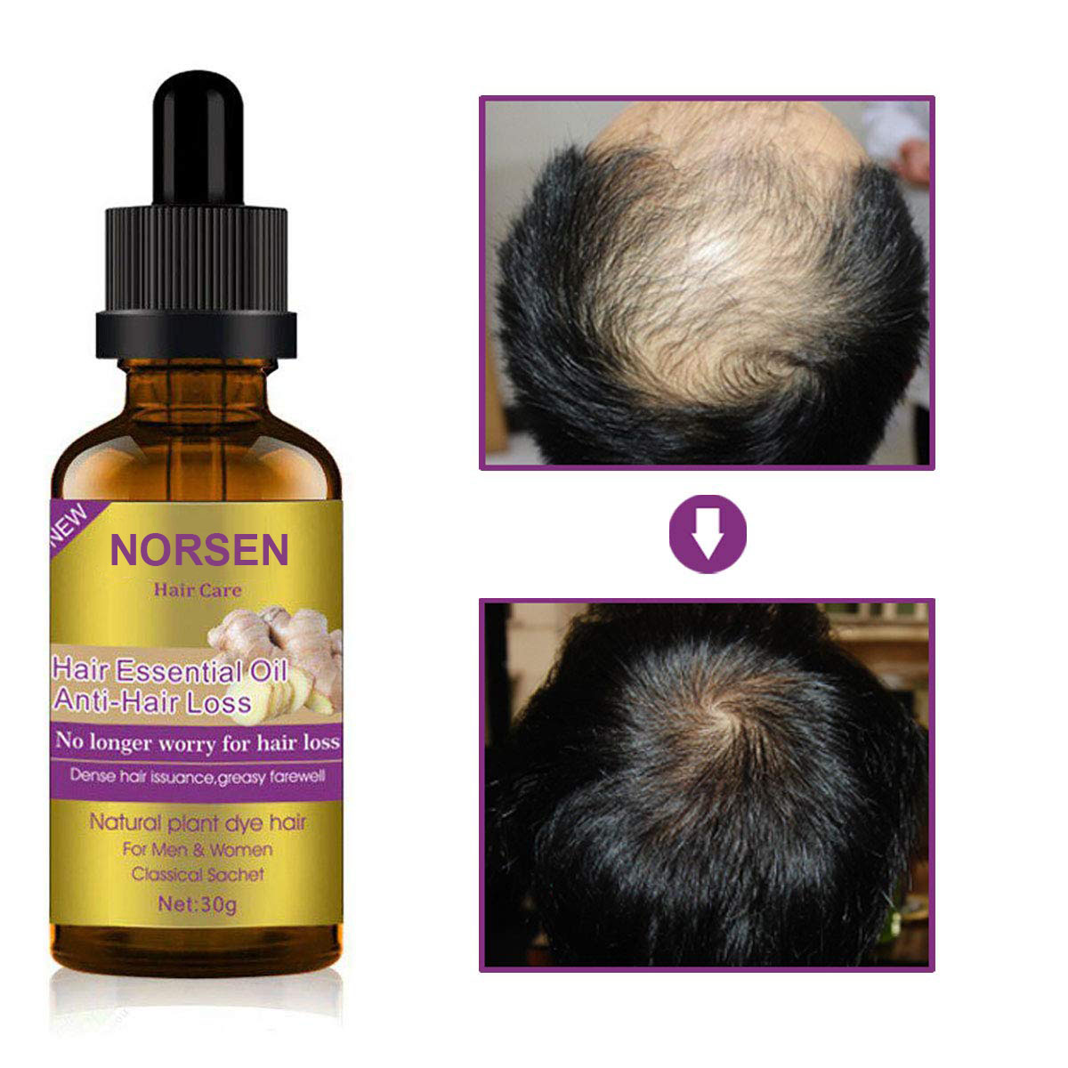 Factory Wholesale High Quality Pure Natural Organic Hair Growth Essential Oil