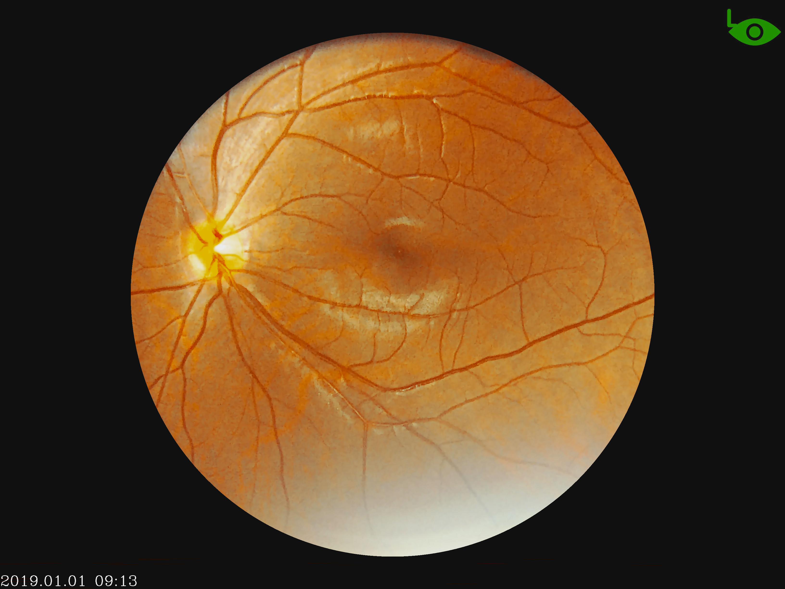 in-v042-1 眼科设备视网膜便携式眼底摄像机