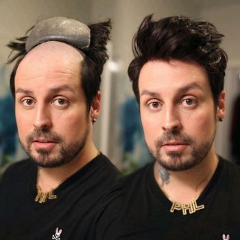 薄皮肤v形环结无聚皮肤基础人发假发男性天然发际线头发置换假体