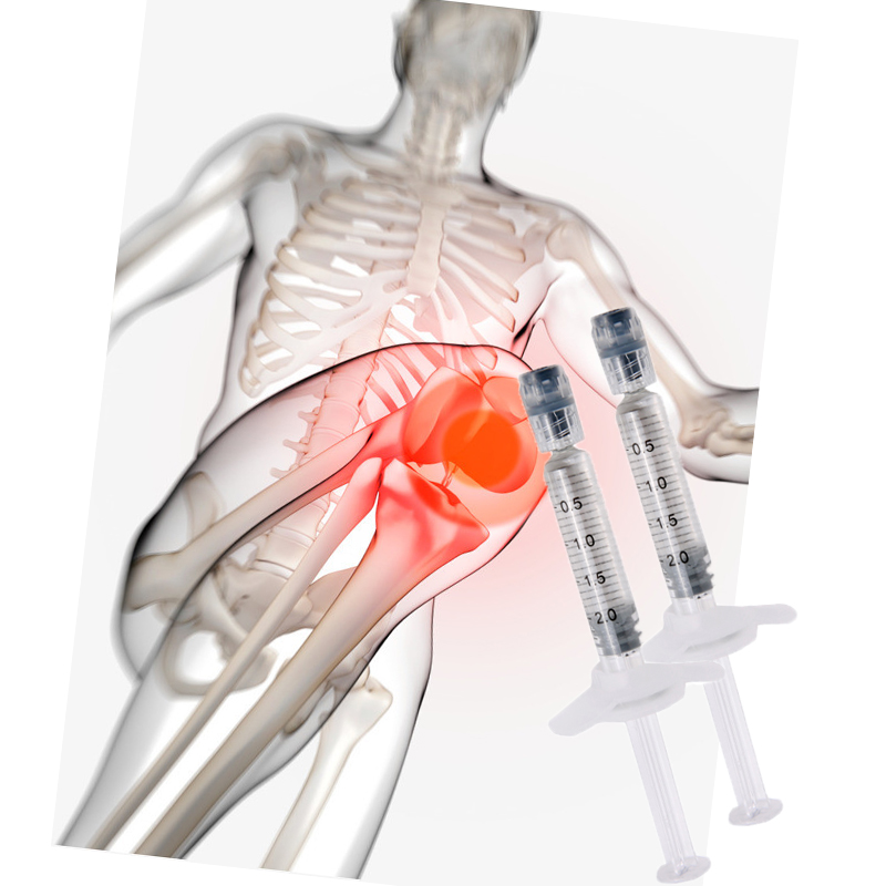 Препарат в коленный сустав 1 укол. Лекарство для суставов уколы внутримышечно. Хондропротекторы для суставов уколы. Введение гиалуроновой кислоты в сустав. Гелевые уколы в сустав.