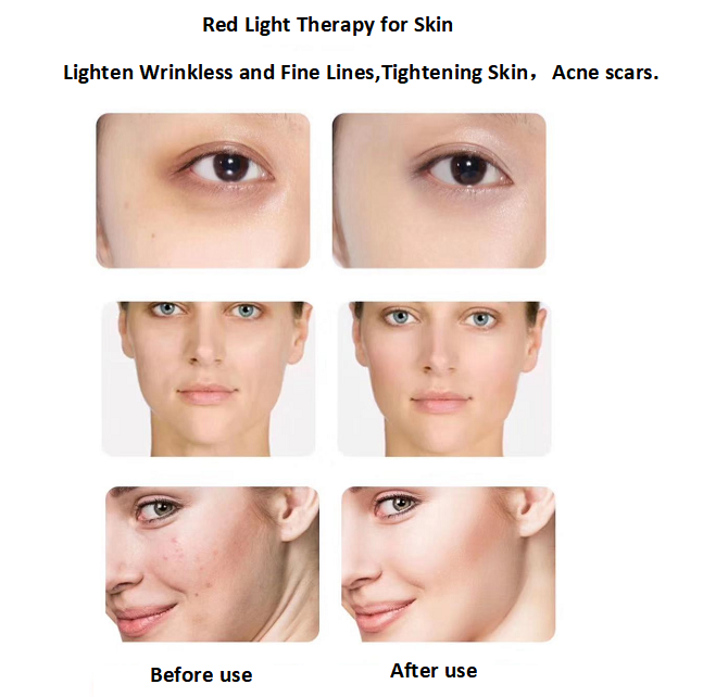 54W Red Light Therapy Bulbs 660nm 850nm LED Therapy Light For Skin Rejuvenation