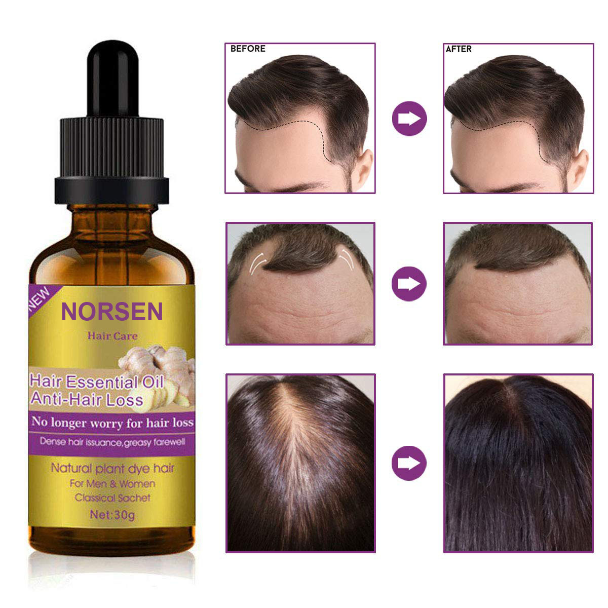 Factory Wholesale High Quality Pure Natural Organic Hair Growth Essential Oil